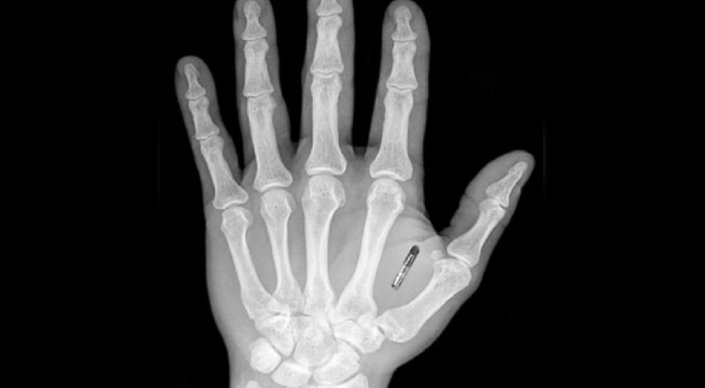 الەمدە كومپانيالار قىزمەتكەرلەرىنە ميكروچيپ ەندىرۋدە