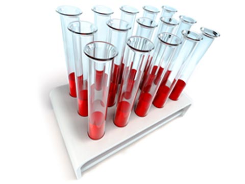 قازاق­ستان­دا «گەموفيليا» دياگنوزى بار 1273 ناۋقاس ەسەپتە تۇر