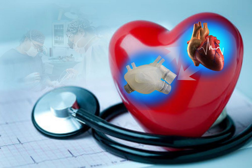 ۇلتتىق كارديوحيرۋرگيا ماماندارى جۇرەك اۋىستىرۋ جونىنەن الەم نازارىن اۋدارعان بىرەگەي وپەراتسيا جاسادى