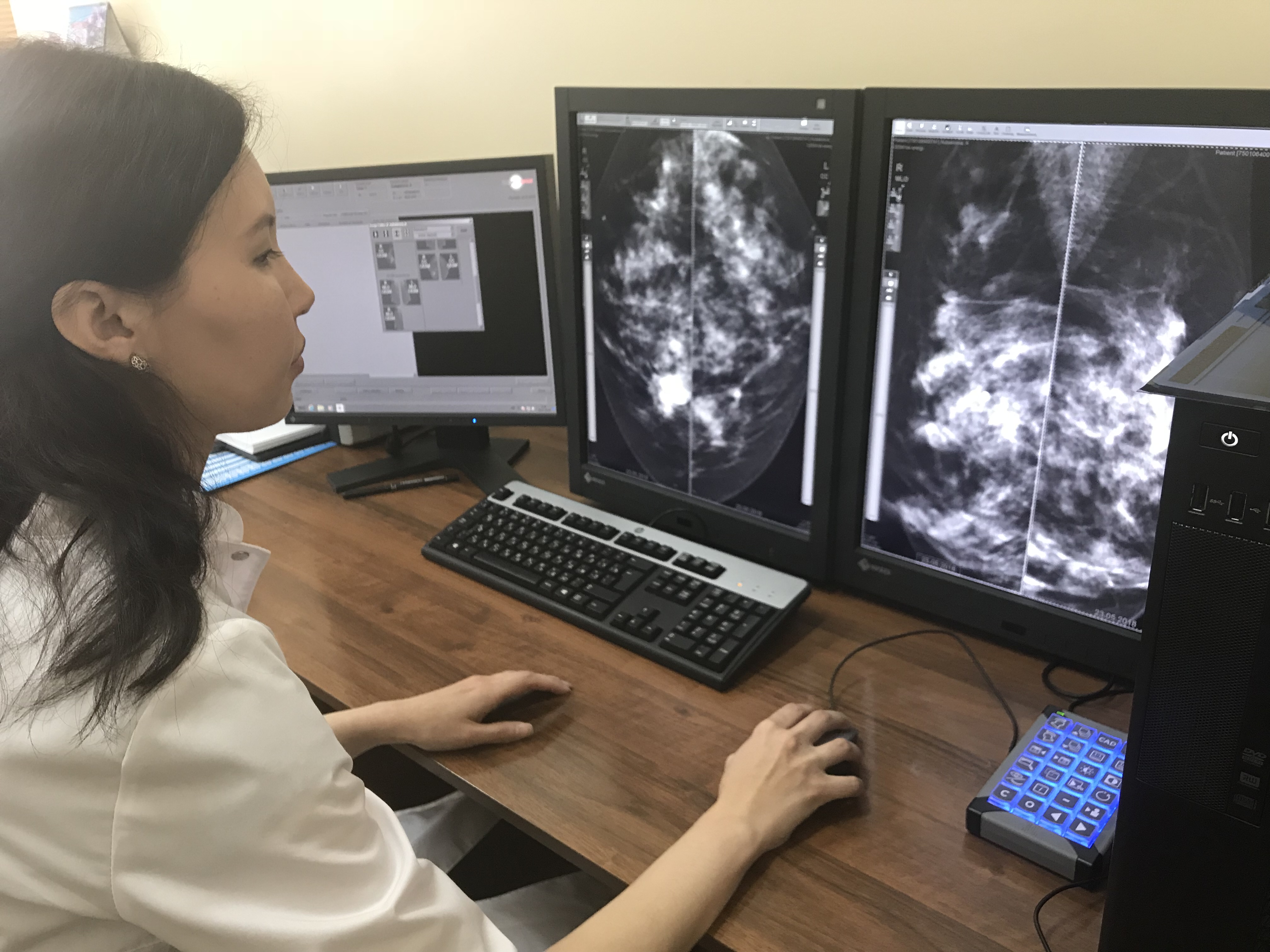 ۇكىمەتتىڭ ونكولوگيالىق اۋرۋلاردىڭ الدىن الۋ جونىندەگى كەشەندى جوسپارى جۇزەگە اسىپ وتىر ما؟