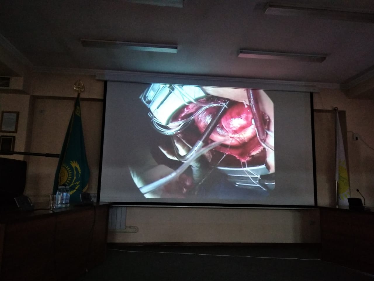 وتاندىق دارىگەرلەرىمىز العاش رەت نەمىس كارديولوگتارىمەن بىرگە وتانىڭ جاڭا ءتۇرىن جاسادى