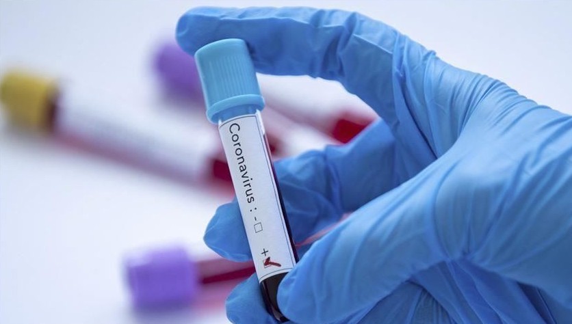 ەلىمىزدە ۆيرۋس جۇقتىرعاندار سانى 59-عا جەتتى