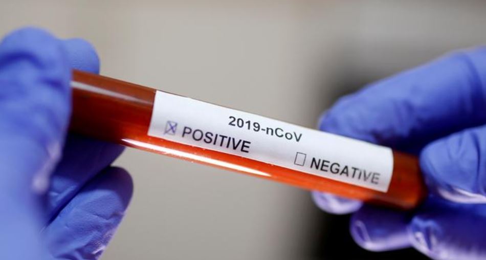 پاندەميانىڭ اۋىر شەڭگەلى ەلىمىزدىڭ باتىس وڭىرىنە دە اۋىز سالا باستادى