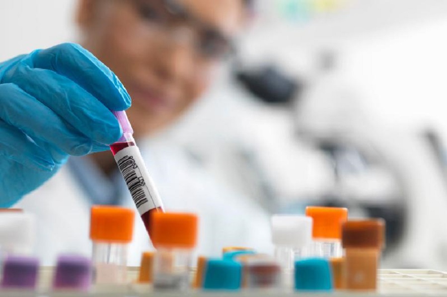 100 جىلدا ءبىر رەت جەرگە ۇلكەن اۋرۋ كەلەدى. سايكەستىك پە؟