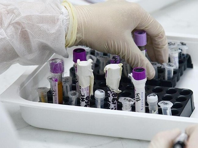 سقو: كوروناۆيرۋس جۇقتىرعان قىزدىڭ جاعدايى بىرقالىپتى