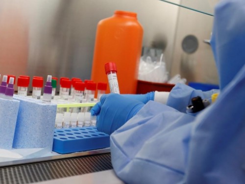 تۇركىستان وبلىسى: كوروناۆيرۋس جۇقتىرعان اداممەن بىرگە كەلگەن 10 جولاۋشى ىزدەستىرىلىپ جاتىر