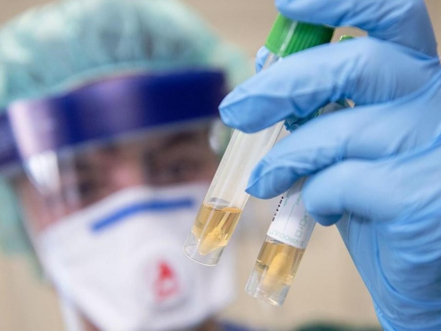 COVID-19: ۆيرۋستىق گەنوتسيد جəنە ىندەتتىڭ əلەمدىك دەموگرافياعا əسەرى