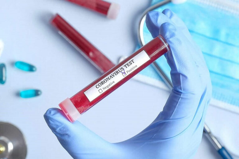 قىزىلوردا: كوروناۆيرۋس ەمحانا مەدبيكەسىنەن انىقتالدى