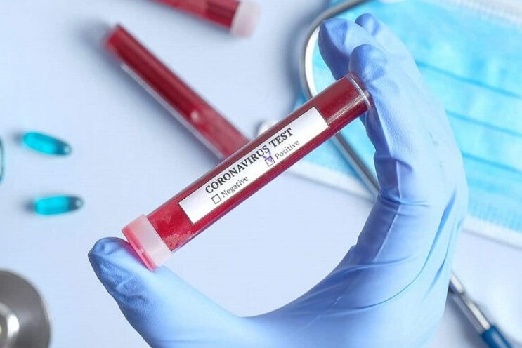 قىزىلوردا: تاعى ءۇش ادامنان ينفەكتسيا انىقتالدى