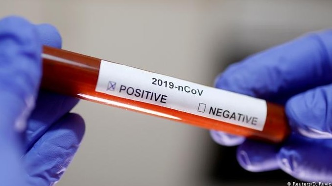 اتىراۋدا 700-گە جۋىق ەكسپرەسس-تەست بار