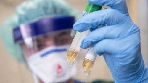 قاراعاندىدا 6 ستۋدەنتتەن كوروناۆيرۋس بەلگىسى تابىلدى