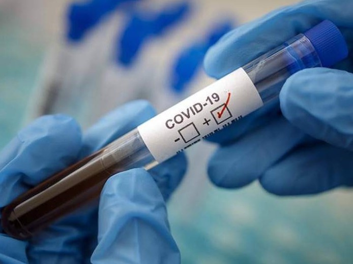 شىمكەنتتە تاعى ءبىر ازامات كوروناۆيرۋس جۇقتىرعان