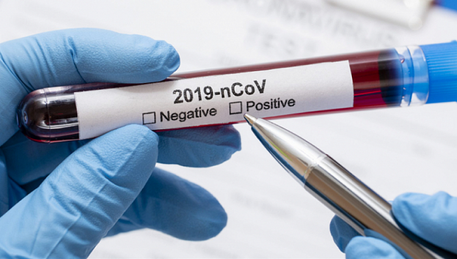 تۇركىستان: ينفەكتسيا جۇقتىرعاندار نۇر-سۇلتان مەن الماتىدان كەلگەن