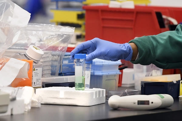 تۇركىستان وبلىسىندا تاعى 3 ادامنىڭ ىندەت جۇقتىرعانى انىقتالدى