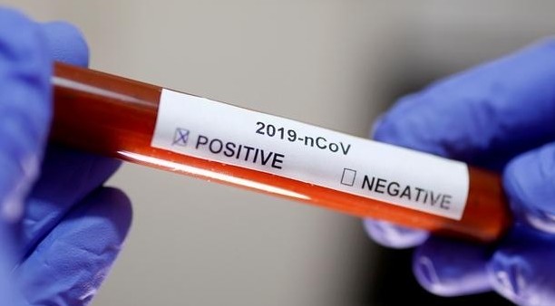 تۇركىستان: اقتاۋدان كەلگەن ارىستىق ازاماتتىڭ ىندەت جۇقتىرعانى انىقتالدى