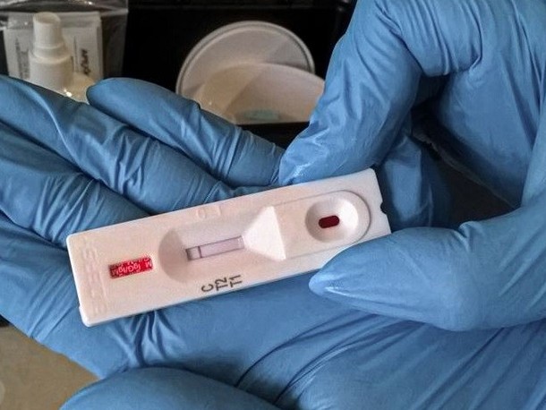 الماتىدا كوروناۆيرۋس جۇقتىرعان دارىگەرلەرگە بايلانىستى ەپيدەميولوگيالىق تەرگەۋ باستالدى