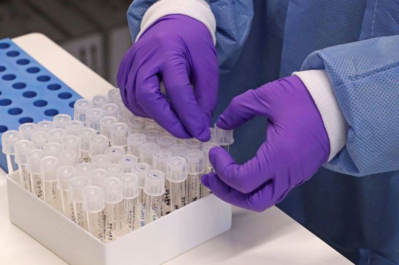 قىزىلوردا: تاعى 2 ناۋقاس دەرتتەن ايىقتى