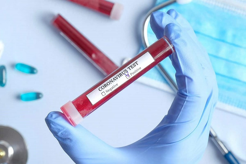 قىزىلوردا: پويىز جولسەرىگىنەن ىندەت بەلگىسى انىقتالدى