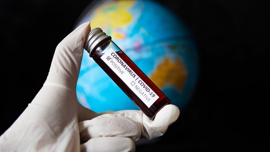 جامبىل وبلىسىندا كوروناۆيرۋستىڭ تاعى ءبىر جاعدايى انىقتالدى