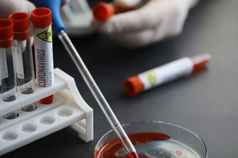 وتاندىق عالىمدار كوروناۆيرۋستى انىقتايتىن تەست جۇيەسىن ازىرلەۋدى جالعاستىرۋدا