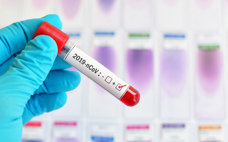 قازاقستاندا كوروناۆيرۋس جۇقتىرعان تاعى 43 ادام تىركەلدى