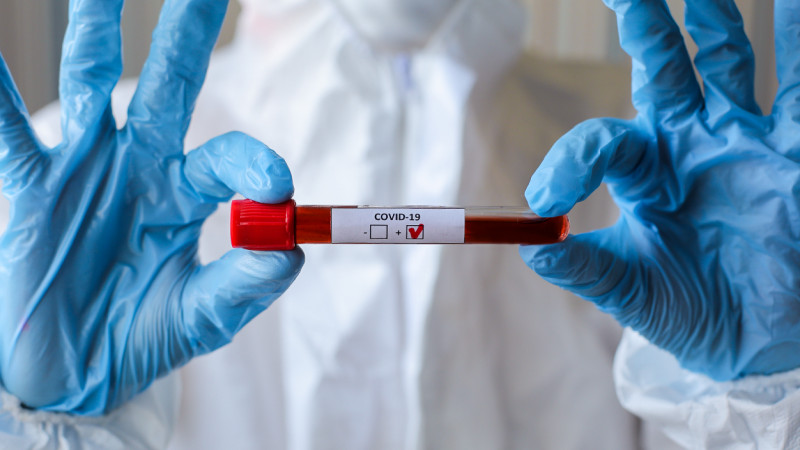 جامبىل: ۆيرۋس جۇقتىرعان ازامات اتىراۋدا ۆاحتالىق نەگىزدە جۇمىس ىستەيدى