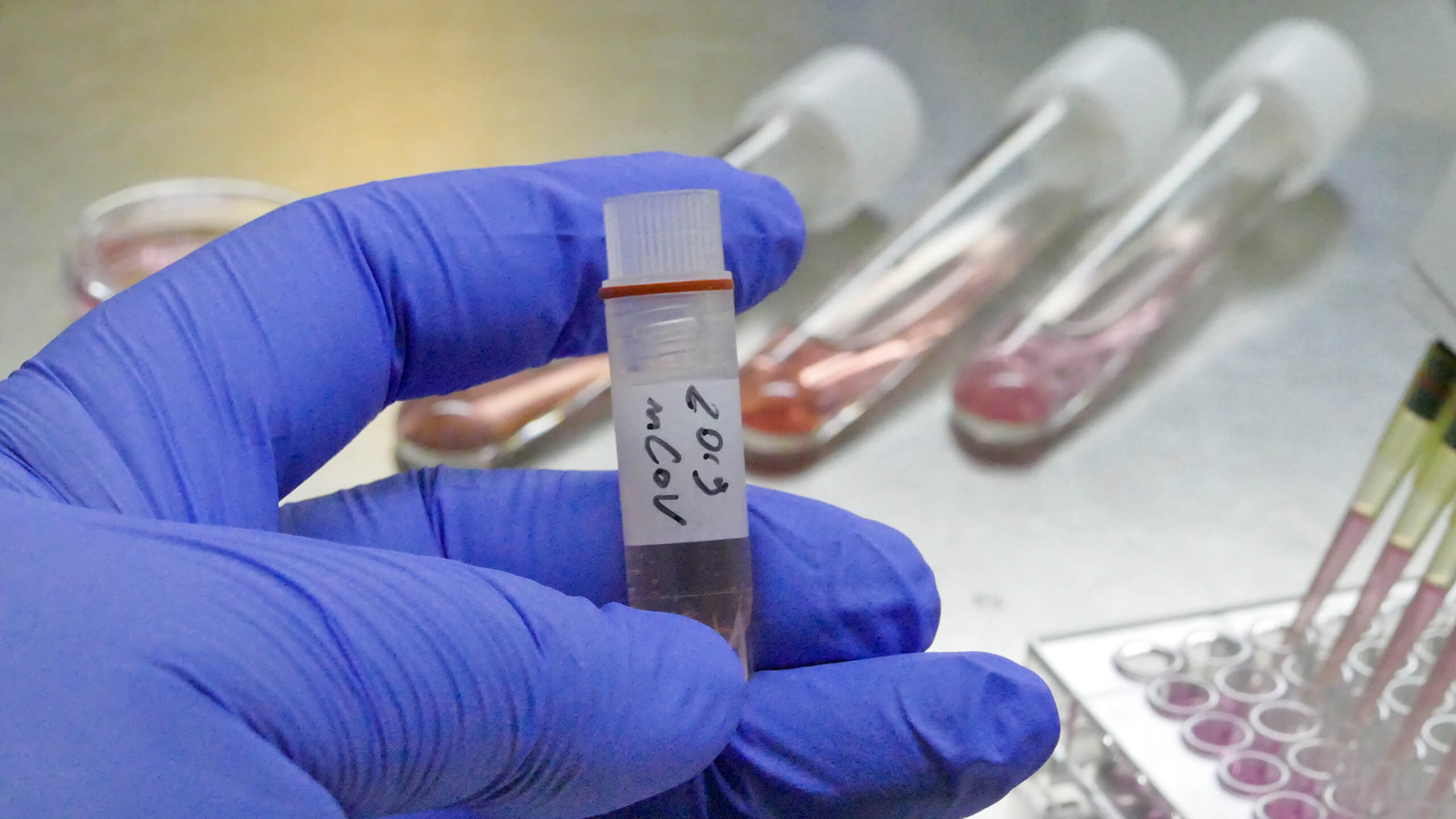 كوروناۆيرۋس جۇقتىرعان ناۋقاستاردىڭ ءولىم جاعدايىن زەرتتەۋ جونىندەگى كوميسسيالار قۇرىلدى