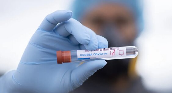 2791 ناۋقاس: كوروناۆيرۋس ينفەكتسياسىن جۇقتىرعان تاعى 11 ادام تىركەلدى