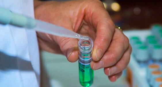 الماتى قالاسىندا كوروناۆيرۋس جۇقتىرعاندار سانى ءبىر ادامعا ارتىق كورسەتىلگەن