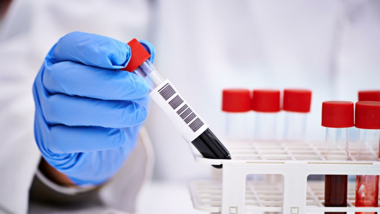 ەلىمىزدە ىندەت جۇقتىرعاندار سانى 3356-عا جەتتى