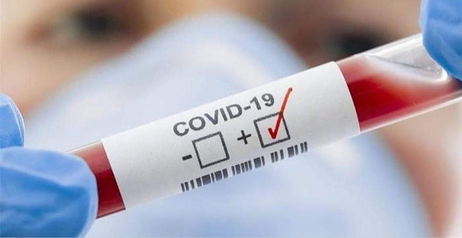 شىمكەنتتە تاعى 3 ازاماتتىڭ كوروناۆيرۋس ينفەكتسياسىن جۇقتىرعانى انىقتالدى