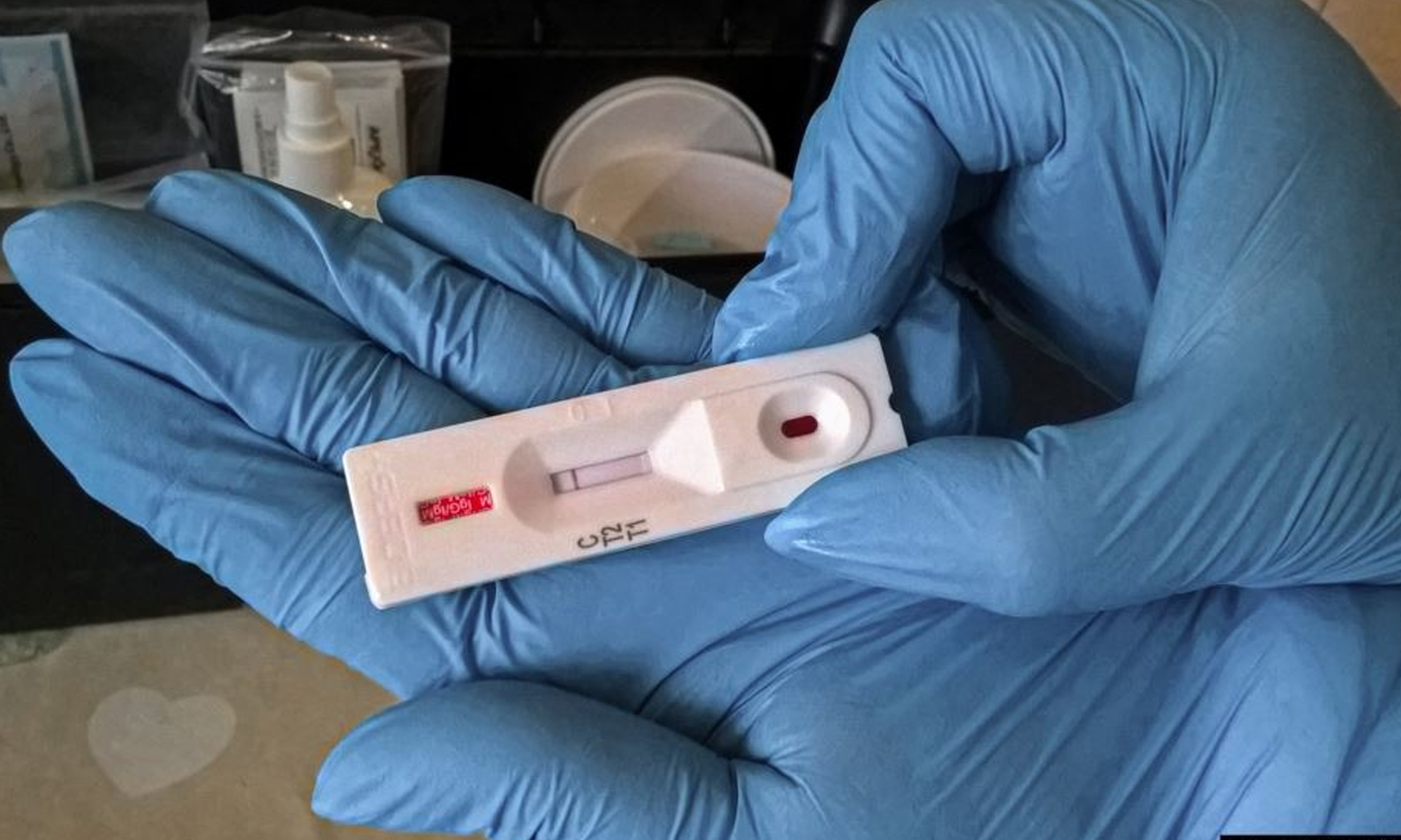 قاراعاندى وبلىسىندا كوروناۆيرۋس جۇقتىرعان 2 ناۋقاس تىركەلدى