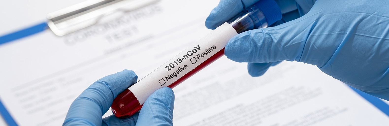 پتر ادىسىمەن كوروناۆيرۋسقا اقىلى تەست جاساتۋ قۇنى تومەندەدى