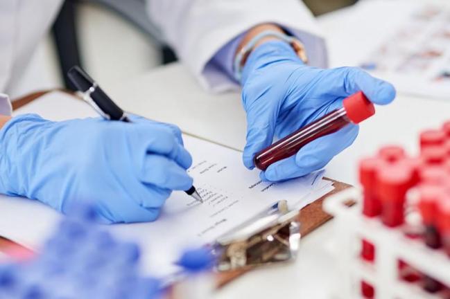 شىمكەنت قالاسىندا كوروناۆيرۋس ينفەكتسياسىن جۇقتىرعان تاعى 31 ادام تىركەلدى