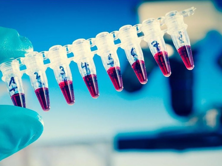 تەڭىز كەنىشىندەگى  جۇمىسشىلاردان 8000-نان استام اناليز الىنعان