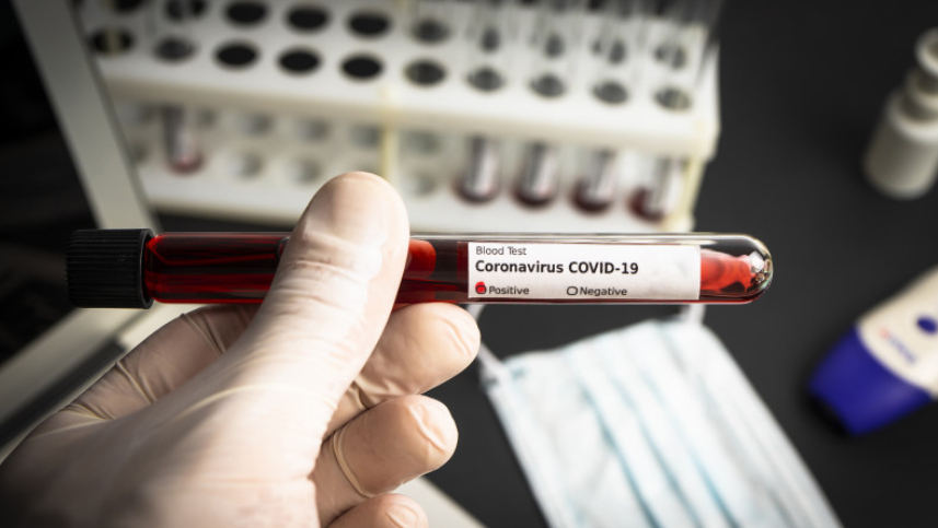 اتىراۋ: ىندەت جۇقتىرعاندار سانى 1024 ادامعا جەتتى