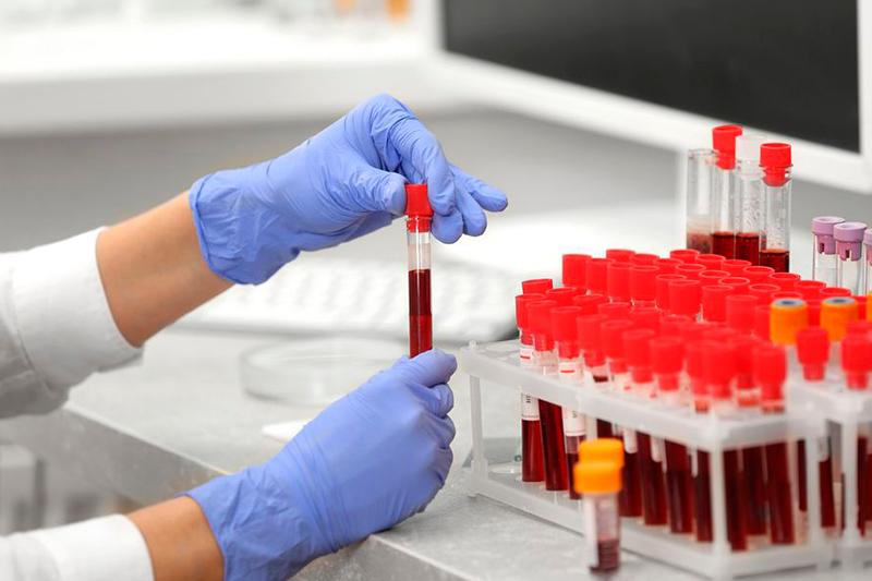 اقمولا وبلىسىندا ءبىر وتباسى تۇگەل ۆيرۋس جۇقتىردى