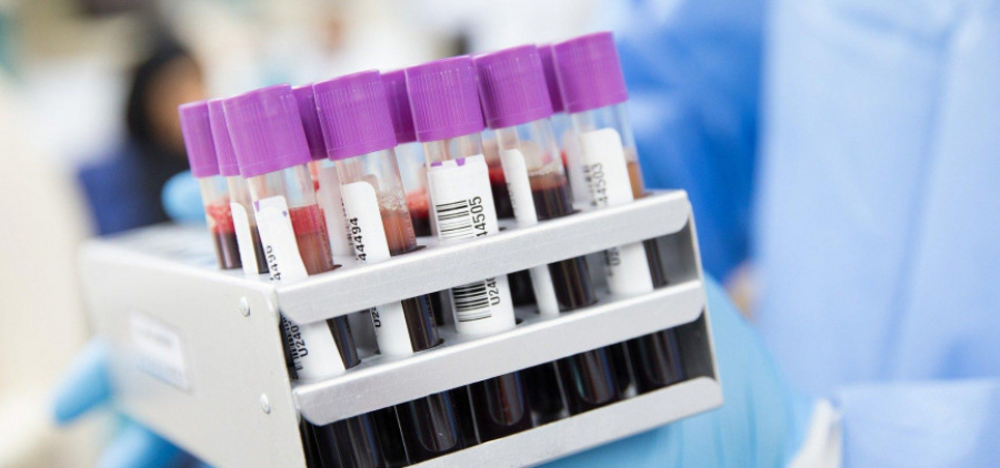 قارجى سەكتورى كوروناۆيرۋستىق داعدارىسقا دايىن بولدى