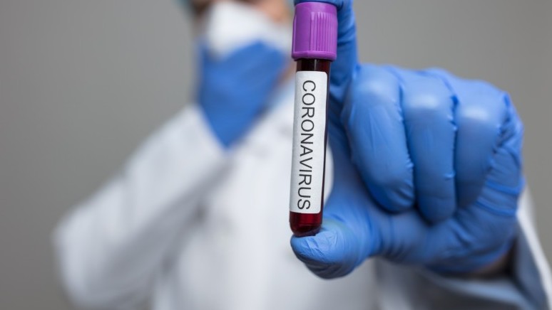 جەتىسۋدا 2479 ادام كوروناۆيرۋس جۇقتىرىپ, 1290 ناۋقاس دەرتتەن ايىقتى