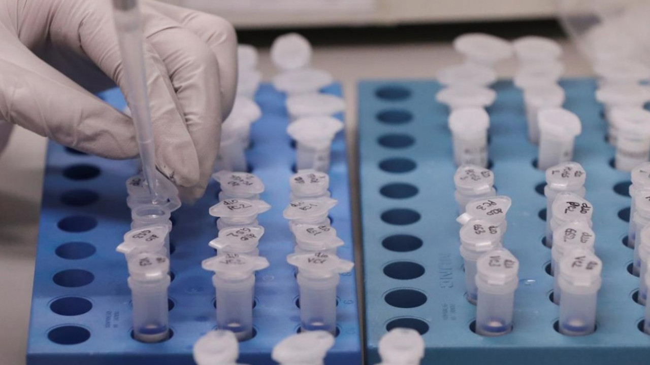 COVID-19: اۋرۋدىڭ التى ءتيپى