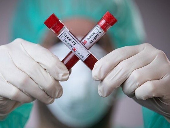 كوروناۆيرۋستى جىلدام انىقتايتىن قۇرىلعى ويلاپ تابىلدى