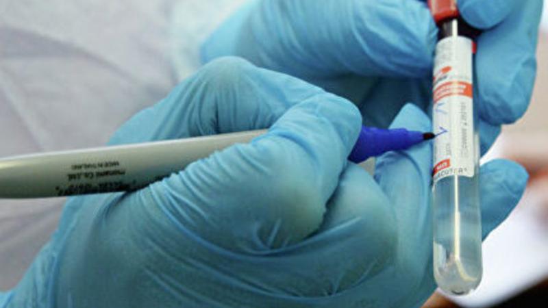 ونكولوگيالىق ناۋقاستار اراسىندا 168 ادام ۆيرۋس جۇقتىرعان