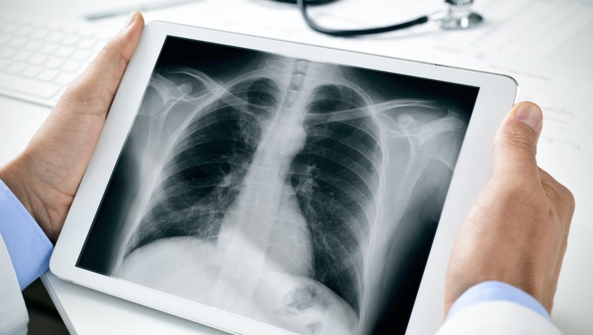 كوروناۆيرۋستان كەيىن اعزانى قالاي قالپىنا كەلتىرۋگە بولادى؟