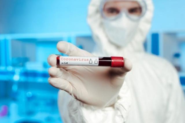 سوڭعى تاۋلىكتە 143 ادامنان ۆيرۋس انىقتالدى