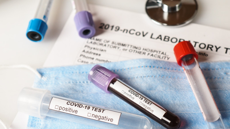 اتىراۋدا تاعى دا 12 ادام قاۋىپتى ىندەتكە شالدىقتى