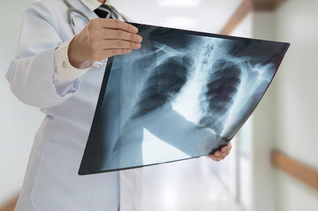 كوروناۆيرۋس جۇقتىرعان 119 ادامنىڭ جاعدايى ناشار