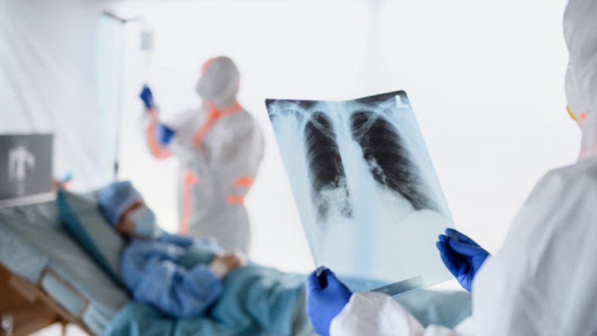 ماڭعىستاۋدا سوڭعى اپتادا 5 ادام Cobid-19, 38 ادام ۆيرۋستىق پنەۆمونيا جۇقتىرعان