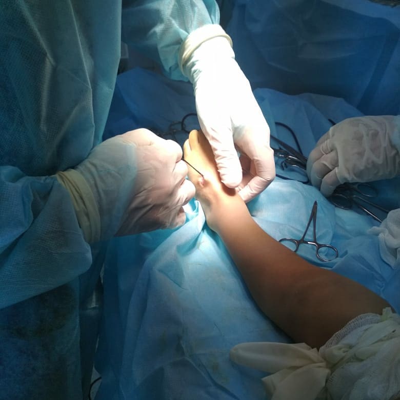 اقتاۋدا ءتۇرلى دياگنوز قويىلعان 17 بالاعا وتا جاسالدى