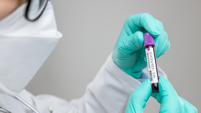 اتىراۋ وبلىسىندا ءۇش تاۋلىكتە 344 ادام كوروناۆيرۋسقا شالدىقتى