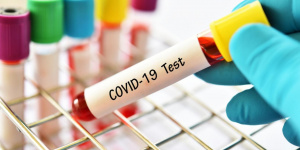 اتىراۋدا كوروناۆيرۋس جۇقتىرعاندار 124 ادامعا كوبەيدى